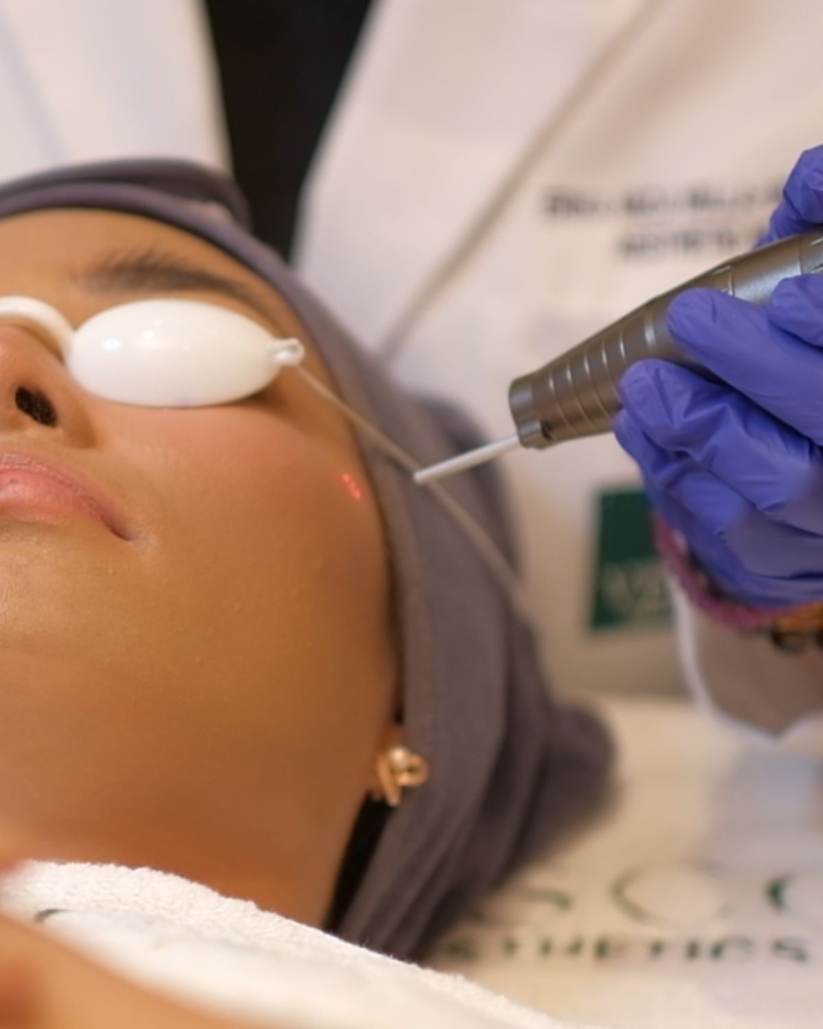 Hollywood Spectra in BGC vs Chemical Peel: An Honest Guide